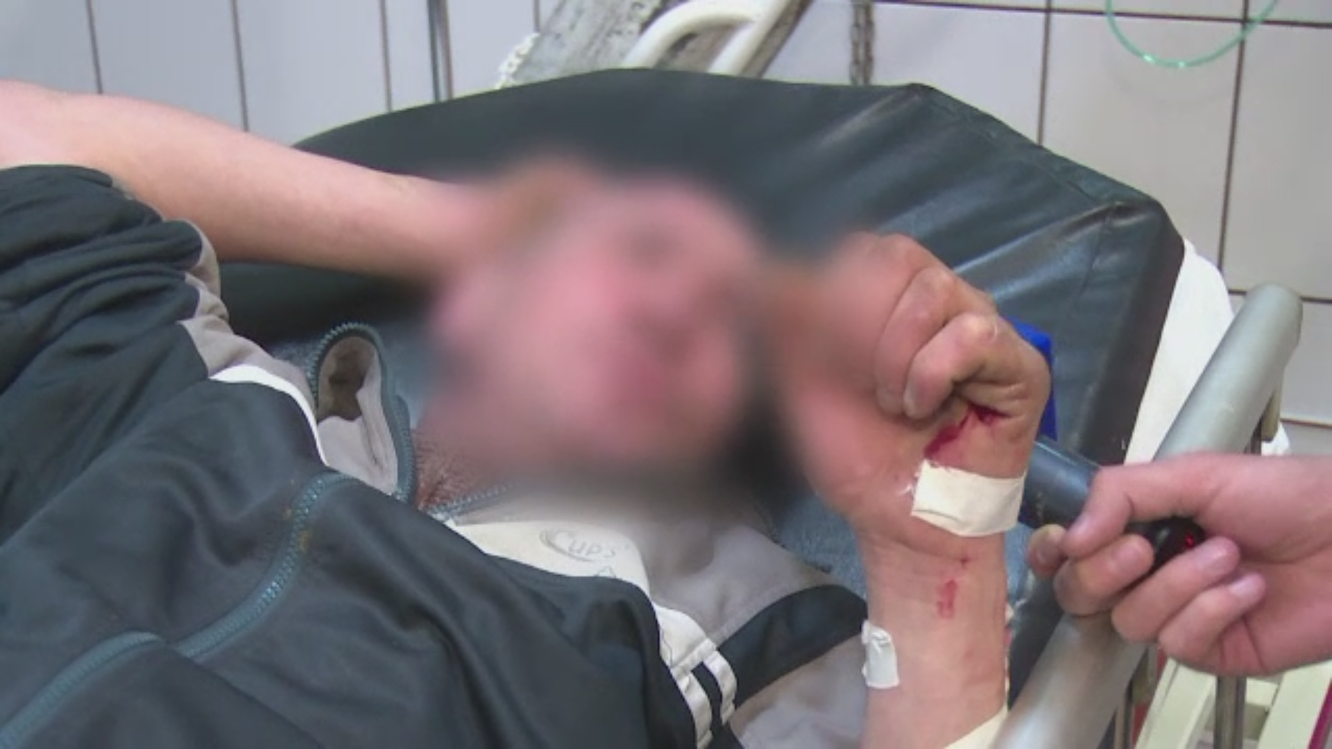 Barbatul din Gaesti pentru care bautura-i mai sfanta decat viata. Cum a ajuns la spital, lovit de o masina