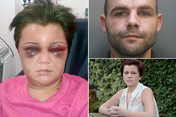 Tanara batuta cu bestialitate de iubit pentru ca nu i-a raspuns la salut. Femeia a fost la un pas de moarte. FOTO