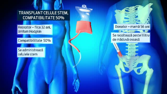Medicii romani au realizat pentru prima data un transplant de celule stem, de la mama la fiica, cu compatibilitate de 50%