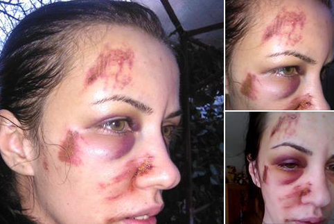 Drama unei tinere din Tulcea, batuta frecvent de fostul iubit. Ce raspuns a primit cand l-a reclamat la politie