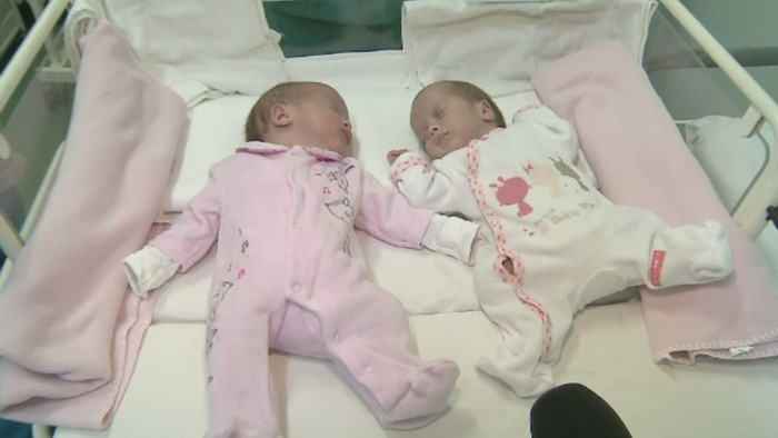 Gemenele care i-au surprins pe medicii din Romania. Maria s-a nascut in noiembrie 2014, iar Ioana abia in 2015