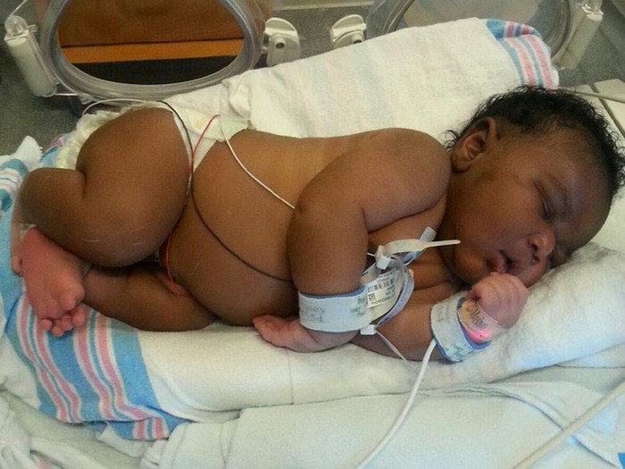 Record in Florida: O femeie a nascut un baietel cu o greutate de 6,4 kilograme