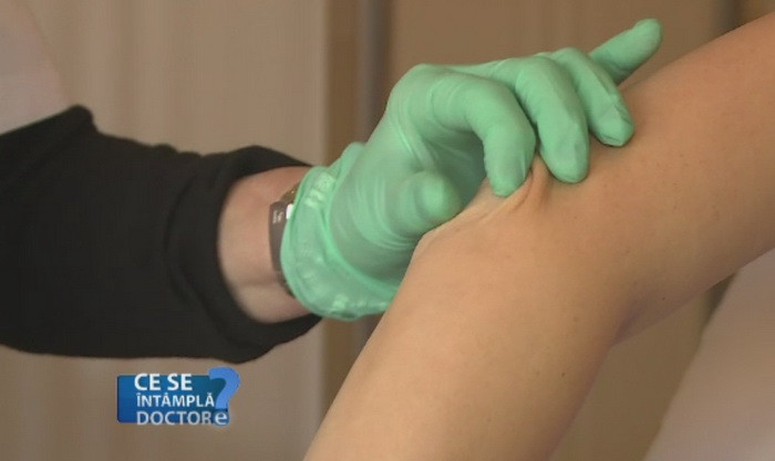 Pericolul din sezonul rece. Ce alergii pot aparea si cand este momentul sa consultati un medic