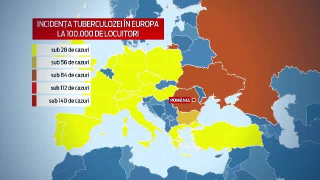 Peste 15.000 de cazuri noi de tuberculoza, in Romania. Aparatura moderna care depisteaza virusul in doua ore