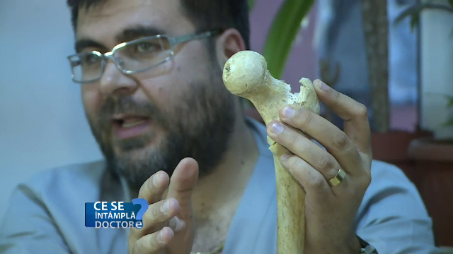 Fracturile de femur au risc crescut la pesoanele sedentare. Cum va puteti proteja de o afectiune care poate deveni fatala