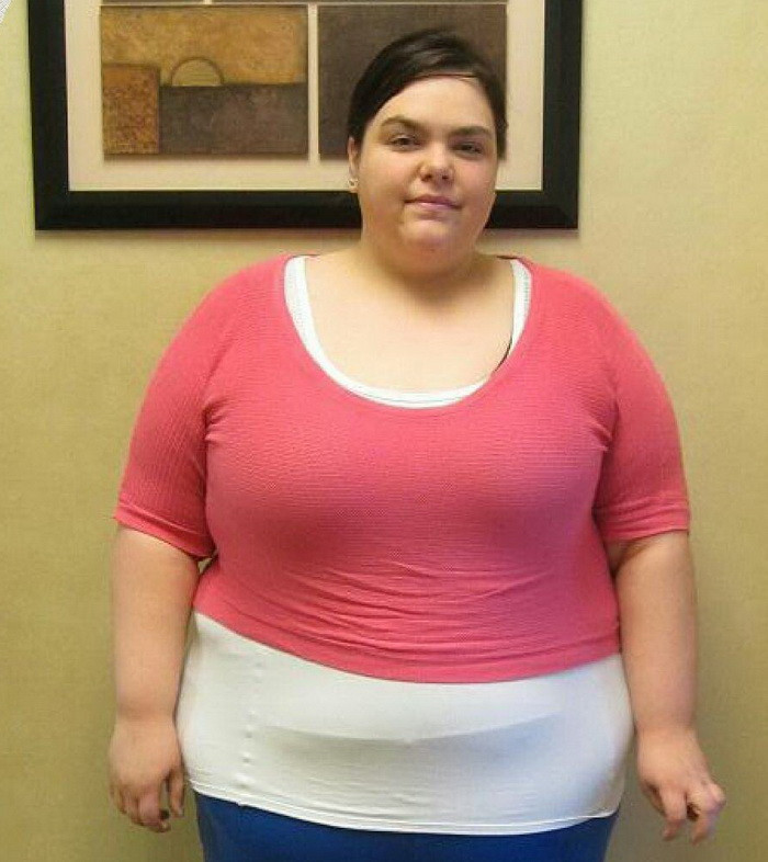 Schimbarea uimitoare prin care a trecut o tanara de 25 de ani. Cum arata fata care avea 160 de kilograme