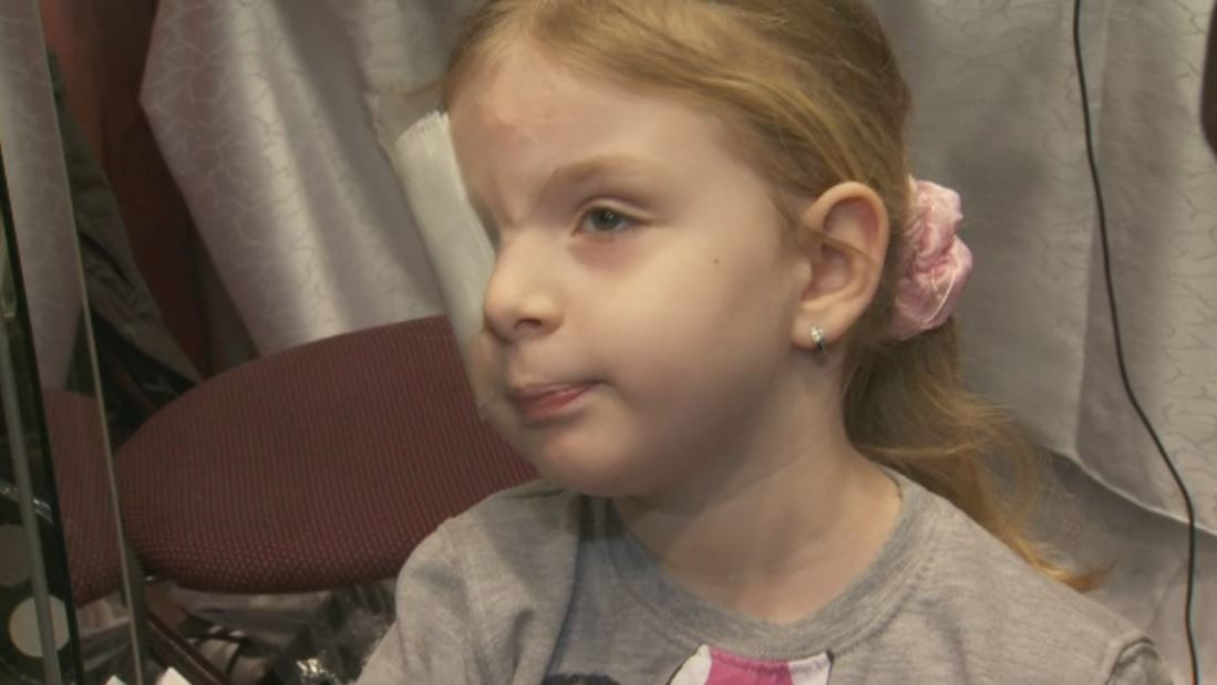 Eveniment caritabil pentru doua surori aflate in prag de orbire. Voluntarii s-au lasat tunsi de stilisti legati la ochi