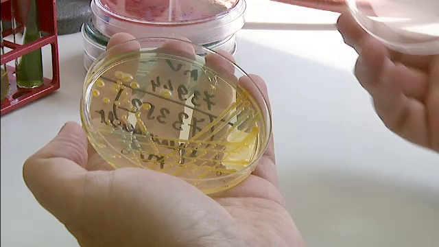 Infectie cu o bacterie ucigasa, depistata la Spitalul de Urgenta din Focsani. Un pacient a murit din cauza complicatiilor