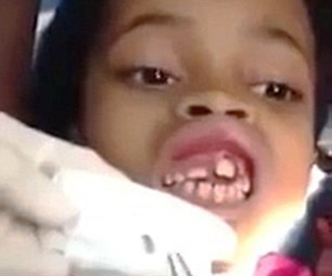 S-a plans ca i se misca ceva in gingie. Ce au gasit stomatologii: va avertizam, imaginile sunt socante. VIDEO