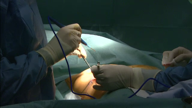 Specialistii din Franta sustin ca implantul mamar poate duce la o forma rara de cancer. Care este explicatia