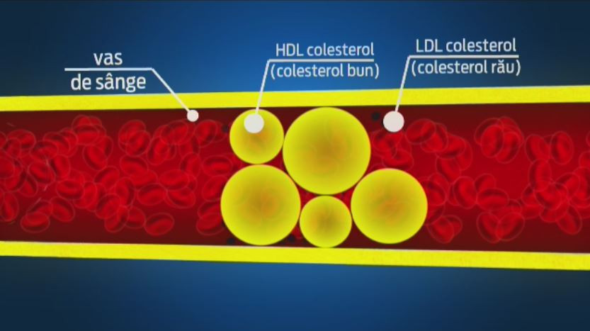 Secretul din spatele "colesterolului bun", care distruge grasimile. Sportul este singurul care poate creste nivelul acestuia