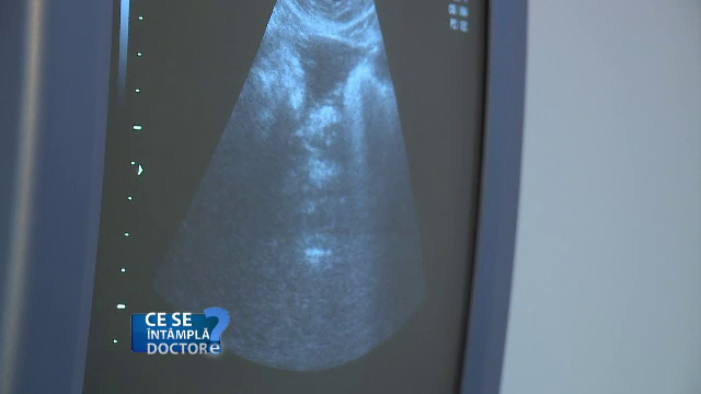 Tineti cont de modul in care functioneaza organismul. De ce trebuie sa anuntati medicul despre modificarile menstruatiei