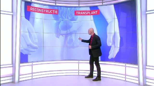 O sansa de a-si reface viata pentru barbatul din Buzau caruia i-a fost amputat penisul. Ce ii promite un chirurg de top