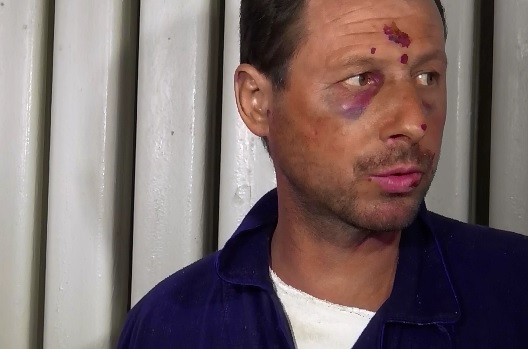 A ajuns la spital plin de vanatai si a spus ca l-au batut mai multi indivizi. Ce s-a intamplat insa in realitate cu omul