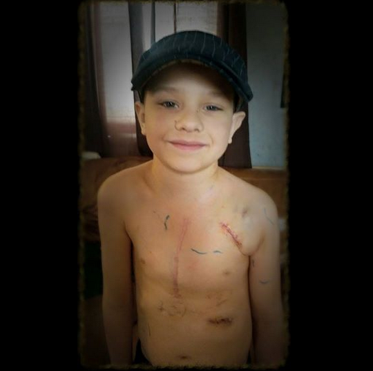 Un baietel a inceput sa planga cand si-a vazut cicatricile. Gestul emotionant al tatalui sau a strans 1 milion de like-uri