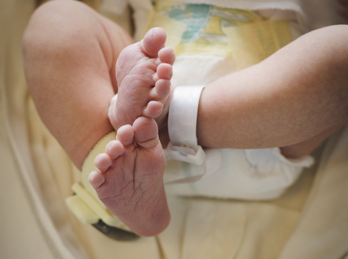 "Sunt mandra ca sunt diferita". Cum arata acum adolescenta pe care copiii o strigau "dalmatian" cand era mica