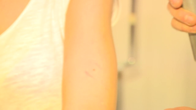 Boala misterioasa care apare primavara si se vindeca de la sine. Ce trebuie sa faceti daca vi se inroseste spontan pielea