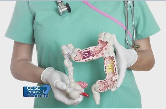 Colonoscopia, analiza simpla care descopera din timp leziunile colonului. De ce trebuie introdusa in setul uzual de analize