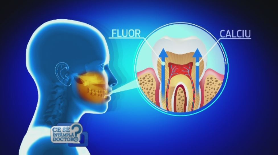 Caria - cea mai frecventa afectiune la nivel mondial, potrivit OMS. Rutina simpla care ne fereste de problemele dentare