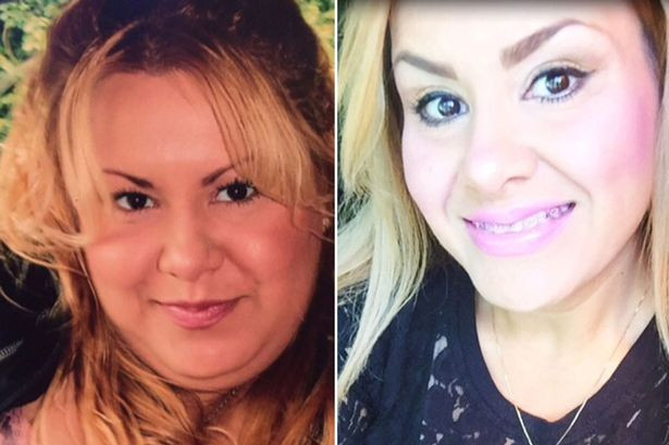 A scapat de barbia dubla in mai putin de o ora. Procedura revolutionara la care a apelat o femeie