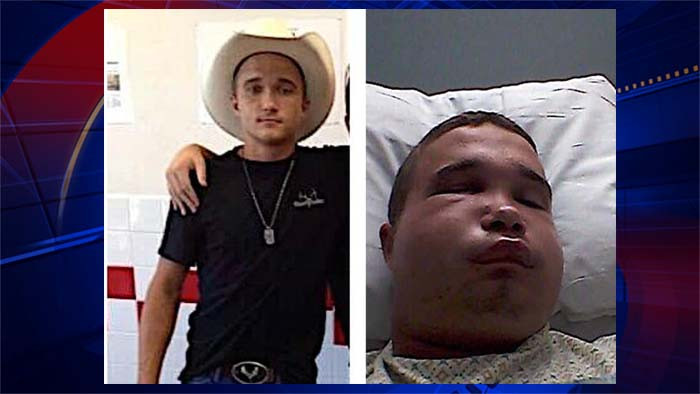 A prins o vipera in rau si a incercat sa o SARUTE. Ce se intampla acum cu tanarul de 18 ani