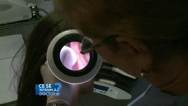 Miturile care ne pun sanatatea in pericol. Vantul nu usuca acneea, iar produsele cosmetice nu fac decat sa o agraveze