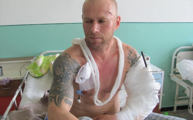 Performanta medicala la Barlad. Medicii au refacut nu doar un brat zdrobit, ci si tatuajul de pe mana