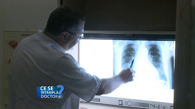 Astmul, boala de care sufera 230 de milioane de oameni. Primele simptome care ar trebui sa va trimita la medic