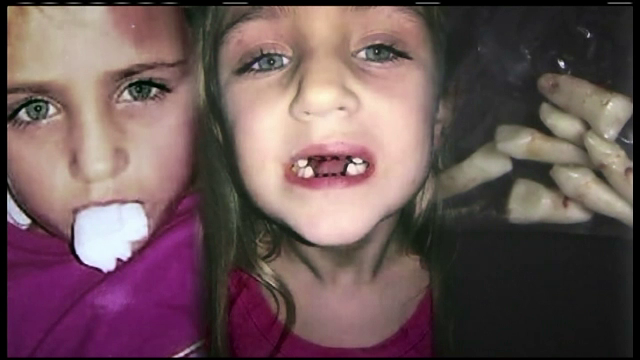 Un stomatolog american s-a imbogatit facand extractii inutile copiilor. O mama l-a filmat in timp ce-i abuza fiica