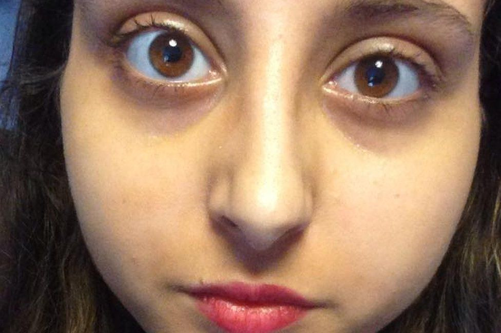 "Un parazit imi manca ochiul". Drama unei tinere dupa ce a folosit o pereche de lentile de contact