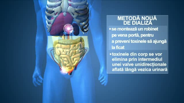 Metoda revolutionara care intra in studii clinice dupa ce 5 ani a stat la sertar. Bolnavii ar putea scapa de dializa clasica