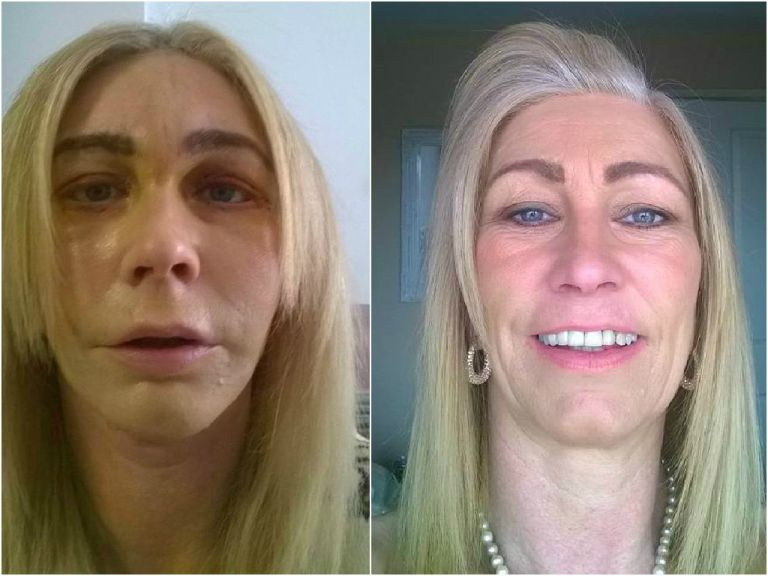O britanica a cheltuit alocatia copiilor pe 12 ani pentru operatiile sale estetice. Cum si-a motivat femeia gestul