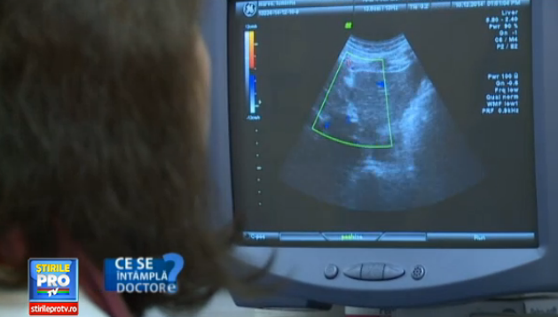 Ati fost diagnosticati cu un chist sau polipi? Chirurgii recomanda excizarea micilor tumori, chiar daca sunt benigne