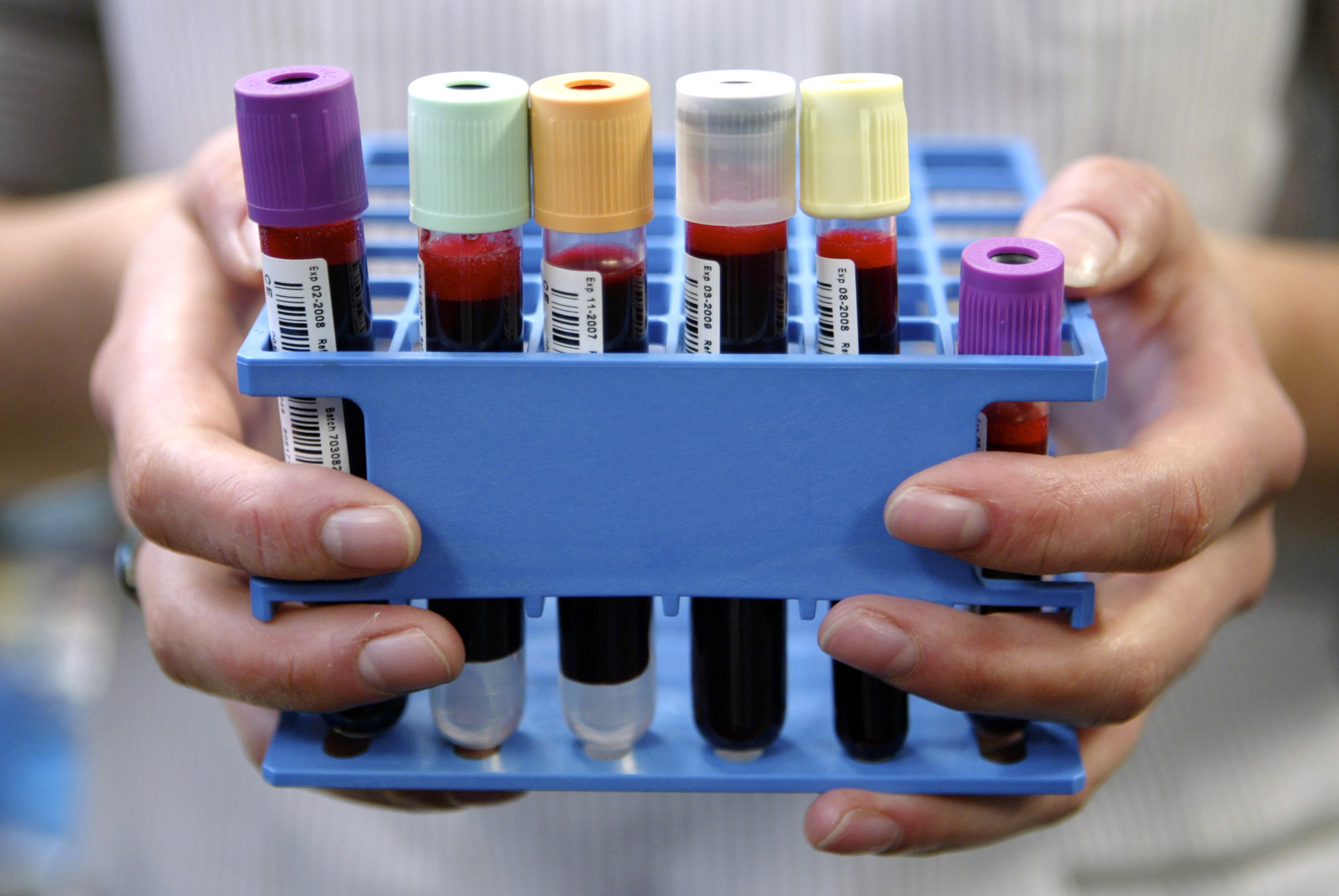 Ubble, chestionarul online care, sustin cercetatorii, iti poate spune daca vei muri in urmatorii 5 ani. Ce intrebari include