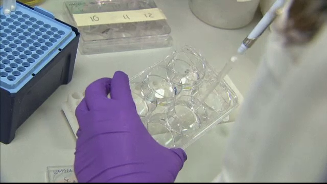 Descoperirea care le da sperante bolnavilor de cancer de piele. Tratamentul le poate prelungi viata cu 5 luni