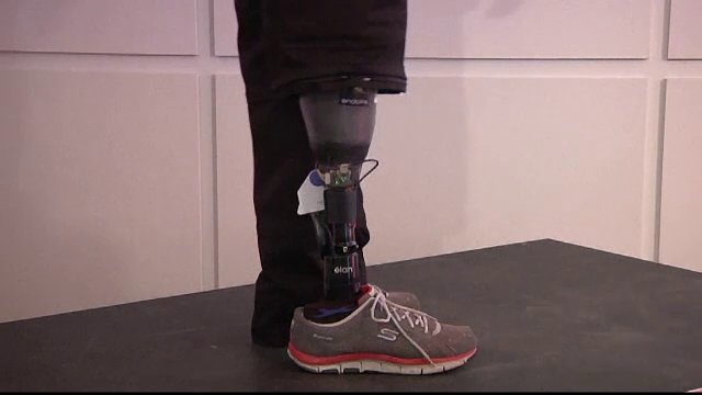 O proteza inteligenta le reda simtul tactil celor fara picioare: "E aproape ca si cum ar fi un picior adevarat"