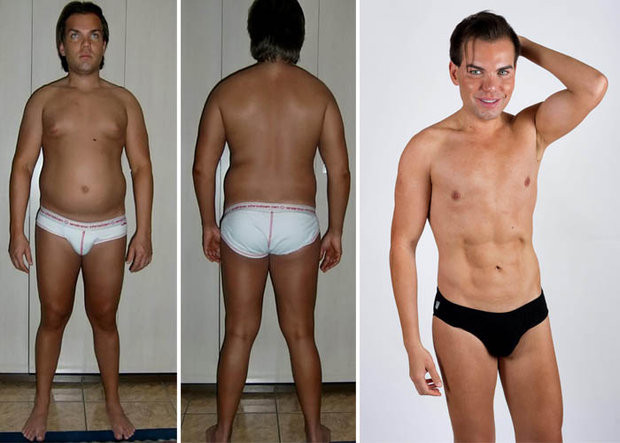 Brazilianul "din plastic" a ajuns la urgente dupa ce ultima operatie estetica i-a distrus nasul. Boala grava de care sufera