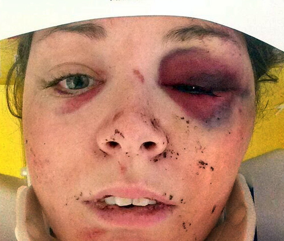 Un selfie i-a salvat viata. Prezenta de spirit a unei femei batute crunt de fostul iubit, dupa ce s-a trezit din coma