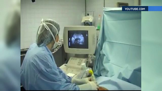 Bebelusii care au nevoie de transfuzii cat inca sunt in burta mamei pot fi salvati, dar doar in cateva clinici din Romania