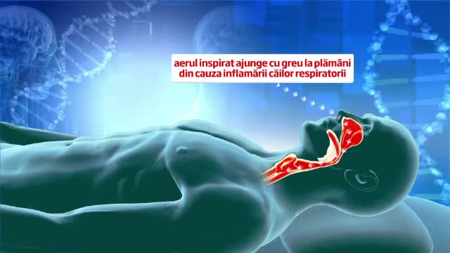 Aproape 300.000 de romani ar trebui sa ramana fara permisul de conducere. Afectiunea care a devenit incompatibila cu sofatul