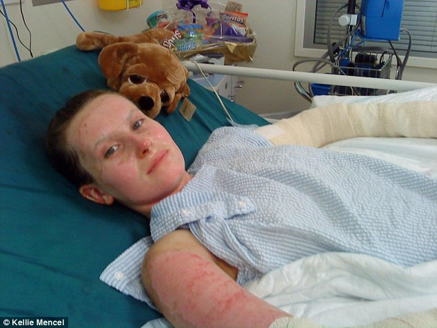 A trecut de doua ori pe langa moarte si a trebuit sa invete sa mearga, din nou. Azi, tanara arata impecabil. FOTO