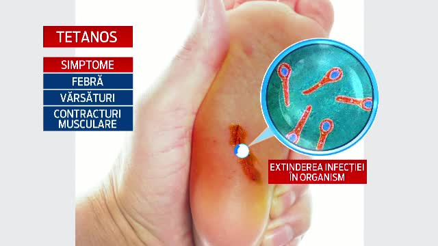 In ultimii 10 ani, medicii de la Matei Bals nu au mai avut asemenea cazuri. Prin ce trec doi copii ce nu au fost vaccinati