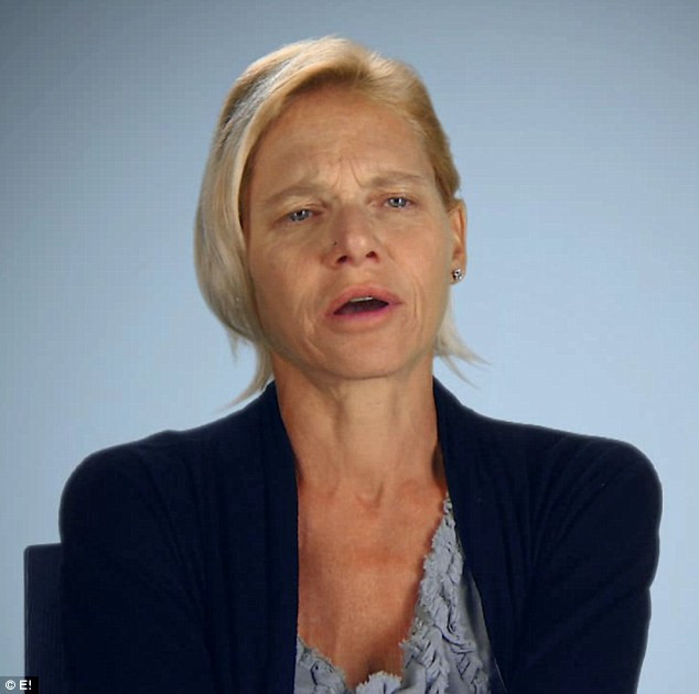 Motivul pentru care medicii au refuzat sa ii scoata implantul mamar. Cum arata sanii acestei femei. Imaginile sunt socante