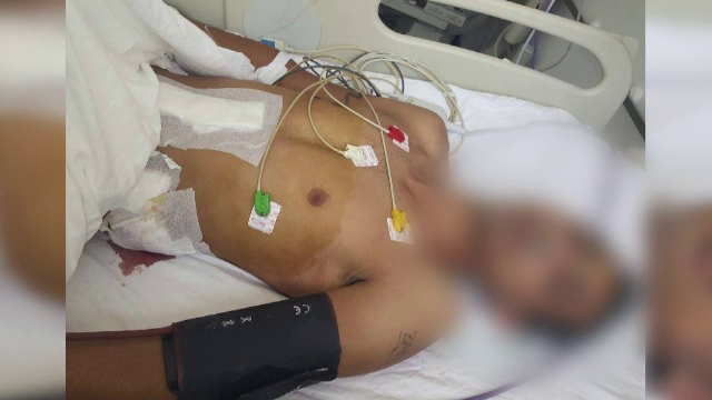 O cearta intre doi frati s-a transformat intr-un conflict sangeros. Cel care a sarit sa-i desparta a devenit agresor