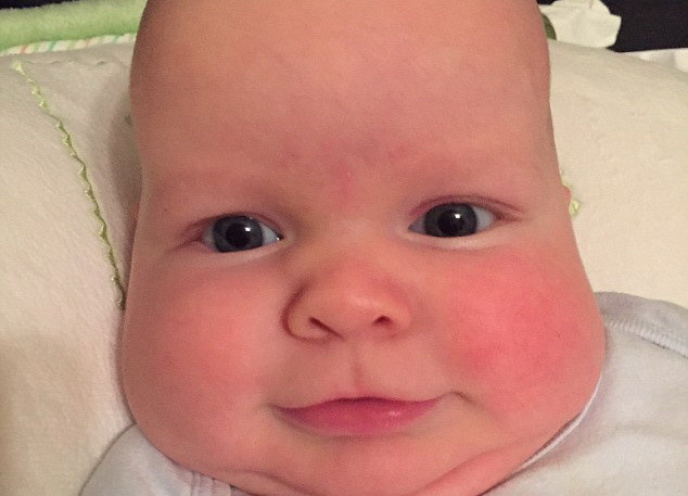 Forma capului bebelusului ei a alertat-o si a mers la control. Diagnosticul medicilor a ingrozit-o