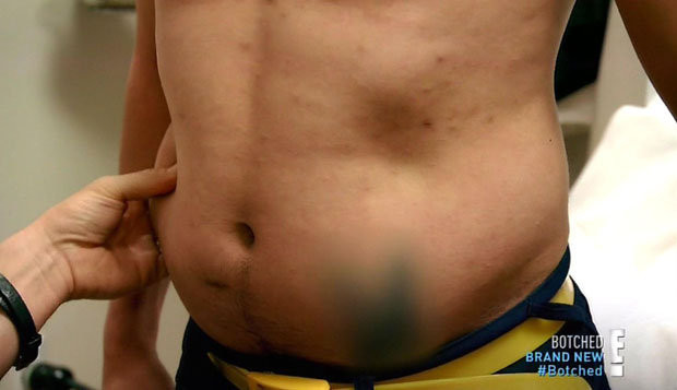 Si-a facut 23 de operatii ca sa arate ca Superman!