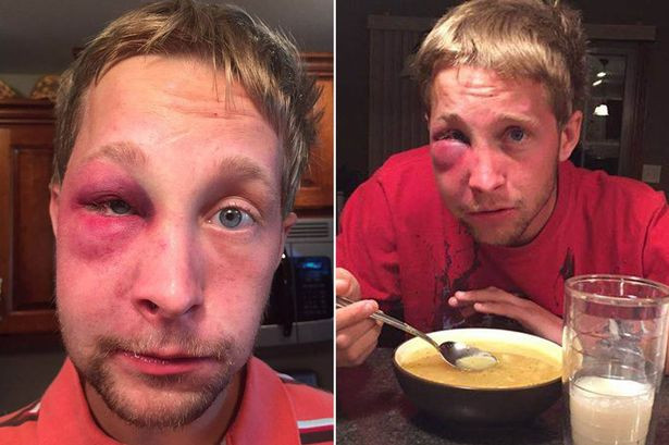 A fost batut crunt si lasat sa zaca pe asfalt doar pentru ca sufera de autism. Raspunsul incredibil al acestui tanar