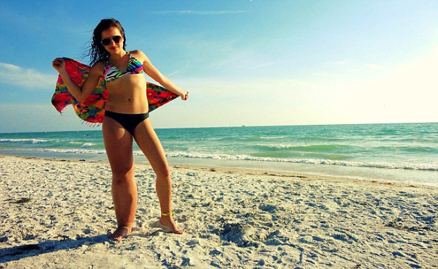 Piciorul ei drept este de doua ori mai gros decat cel stang. Malformatia nu a impiedicat-o sa castige titlul de Miss. FOTO