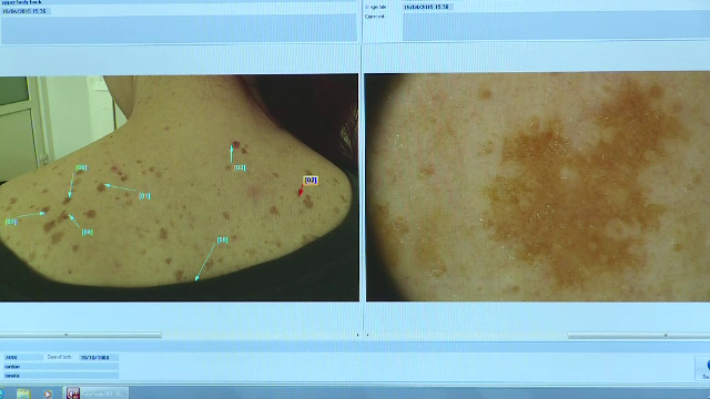 control dermatologic