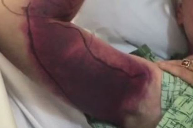 Si-a dorit un selfie cu sarpele, iar acum trebuie sa plateasca 153.000 de dolari pentru acea poza. VIDEO